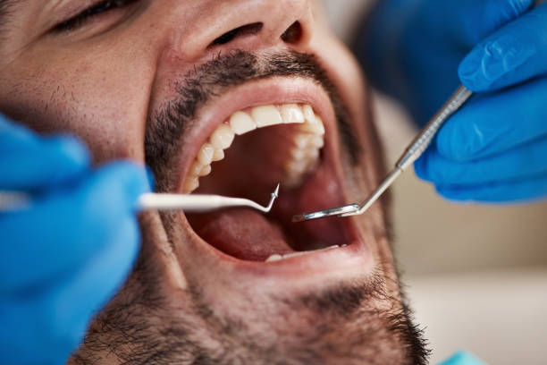 Best Emergency Dentist Open Today  in Cloverdale, CA